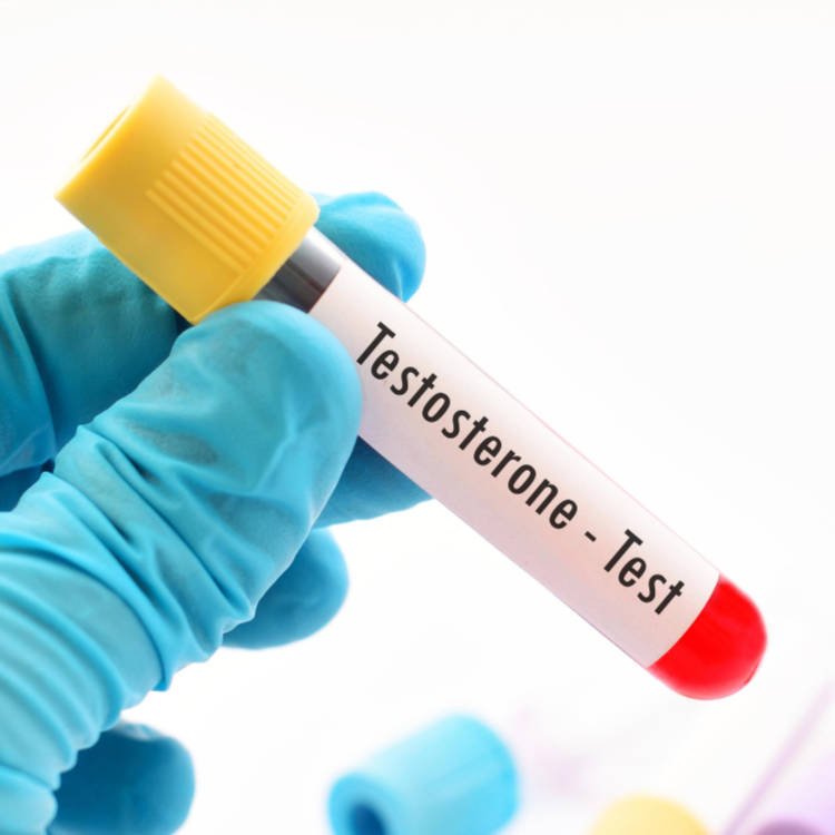 Testosterone Test £81